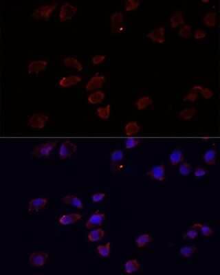 Immunocytochemistry/Immunofluorescence: ARF6 Antibody [NBP2-92599] - Analysis of HeLa cells using ARF6 at dilution of 1:100. Blue: DAPI for nuclear staining.