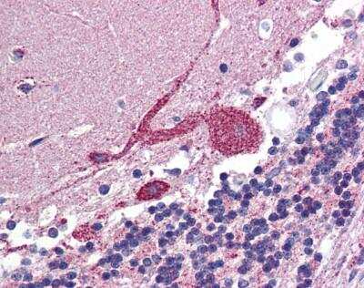 Immunohistochemistry-Paraffin: ARF6 Antibody [NBP1-58310] - Human Brain Tissue (Cerebellum), antibody concentration 5 ug/ml.