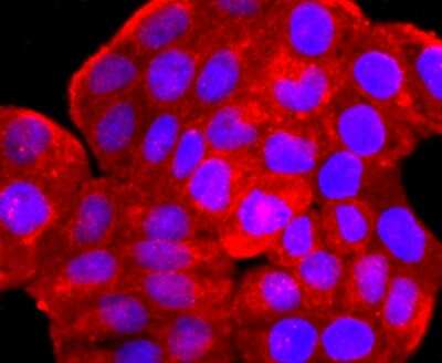 Immunocytochemistry/Immunofluorescence: ARF6 Antibody (JF101-2) [NBP2-67165] - Staining ARF6 in Hela cells (red). The nuclear counter stain is DAPI (blue). Cells were fixed in paraformaldehyde, permeabilised with 0.25% Triton X100/PBS.