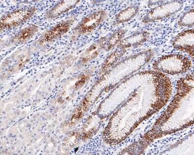 Immunohistochemistry-Paraffin: ARF6 Antibody (JF101-2) [NBP2-67165] - Immunohistochemical analysis of paraffin-embedded human stomach tissue using anti-ARF6 antibody. The section was pre-treated using heat mediated antigen retrieval with Tris-EDTA buffer (pH 8.0-8.4) for 20 minutes. The tissues were blocked in 5% BSA for 30 minutes at room temperature, washed with ddH2O and PBS, and then probed with the primary antibody (1/200) for 30 minutes at room temperature. The detection was performed using an HRP conjugated compact polymer system. DAB was used as the chromogen. Tissues were counterstained with hematoxylin and mounted with DPX.
