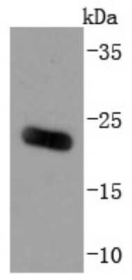 Western Blot: ARF6 Antibody (JF101-2) [NBP2-67165] - Analysis of ARF6 on human liver lysates using anti-ARF6 antibody at 1/1,000 dilution.