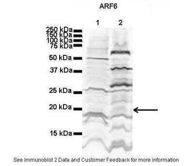 Western Blot: ARF6 Antibody [NBP1-58310] - Titration: 2 ug/ml Positive Control: Human NT-2 cells and Mouse WT brain.