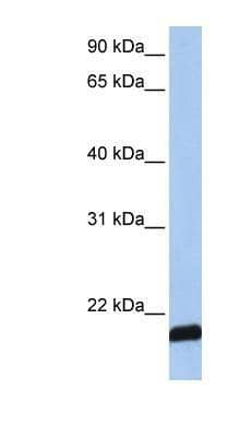 Western Blot: ARF6 Antibody [NBP1-58310] - Titration: 0.2-1ug/ml, Positive Control: MCF7 cell Lysate