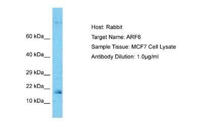 Western Blot: ARF6 Antibody [NBP2-88768] - Host: Rabbit. Target Name: ARF6. Sample Type: MCF7 Whole cell lysates. Antibody Dilution: 1.0ug/ml