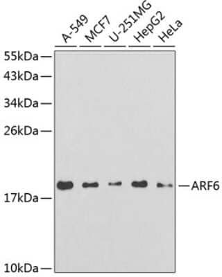 Western Blot: ARF6 Antibody [NBP2-92776] - Analysis of extracts of various cell lines, using ARF6 at 1:250 dilution.Secondary antibody: HRP Goat Anti-Rabbit IgG (H+L) at 1:10000 dilution.Lysates/proteins: 25ug per lane.Blocking buffer: 3% nonfat dry milk in TBST.