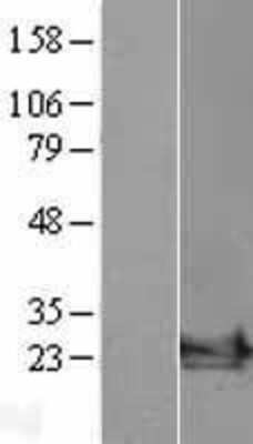 Western Blot: ARF6 Overexpression Lysate (Adult Normal) [NBL1-07654] - Western Blot experiments. Left-Control; Right -Over-expression Lysate for ARF6.