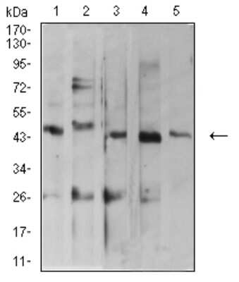 Western Blot: ARFGAP1 Antibody (1C4E2) [NBP2-61670] - Analysis using ARFGAP1 mouse mAb against MOLT4 (1), C2C12 (2), HepG2 (3), MCF-7 (4), and Lncap (5) cell lysate.