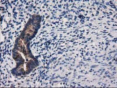 Immunohistochemistry-Paraffin: ARFGAP1 Antibody (1F6) [NBP2-00513] - Staining of paraffin-embedded Human endometrium tissue using anti-ARFGAP1 mouse monoclonal antibody.