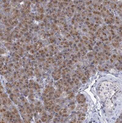 Immunohistochemistry-Paraffin: ARFGAP1 Antibody [NBP2-14305] - Staining of human pancreas shows moderate cytoplasm granular positivity in exocrine glandular cells.