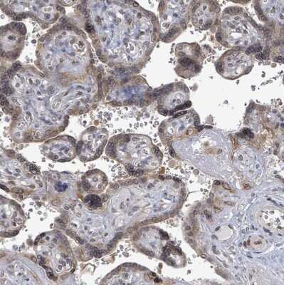 Immunohistochemistry-Paraffin: ARFGAP1 Antibody [NBP2-14305] - Staining of human placenta shows moderate cytoplasmic positivity in trophoblastic cells.