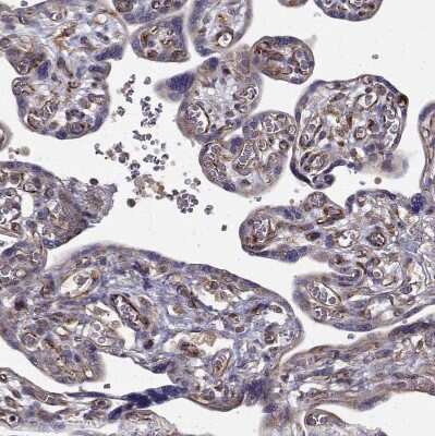 Immunohistochemistry-Paraffin: ARFGAP1 Antibody [NBP2-38787] - Staining of human placenta shows strong cytoplasmic positivity in trophoblastic cells.