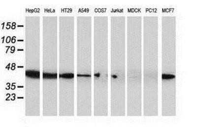 Western Blot: ARFGAP1 Antibody (OTI1F6) - Azide and BSA Free [NBP2-72013] - Analysis of extracts (35ug) from 9 different cell lines by using anti-ARFGAP1 monoclonal antibody.