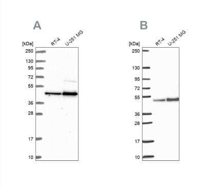 Western Blot: ARFGAP1 Antibody [NBP2-14305] - Analysis using Anti-ARFGAP1 antibody NBP2-14305 (A) shows similar pattern to independent antibody NBP2-38787 (B).