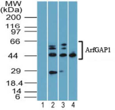 Western Blot: ARFGAP1 Antibody [NBP2-24605] - Analysis of ArfGAP1 using 1) preimmune sera at 1:5000 in human heart and protein A purified this antibody at 2.0 ug/ml.  Goat anti-rabbit Ig HRP secondary antibody and PicoTect ECL substrate solution were used for this test.