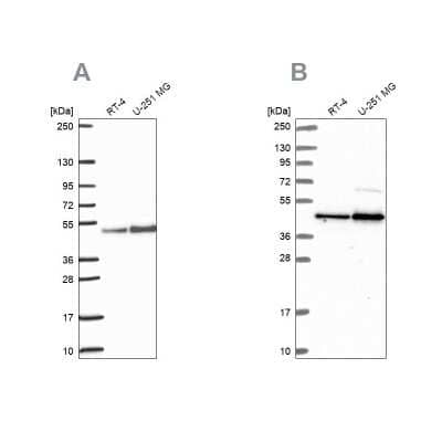 Western Blot: ARFGAP1 Antibody [NBP2-38787] - Analysis using Anti-ARFGAP1 antibody NBP2-38787 (A) shows similar pattern to independent antibody NBP2-14305 (B).