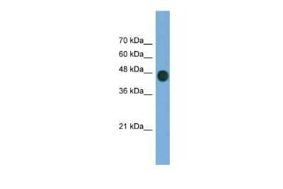 Western Blot: ARFGAP1 Antibody [NBP3-10640] - Western blot analysis using NBP3-10640 on Transfected 293T  as a positive control. Antibody Titration: 0.2-1 ug/ml