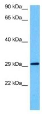 Western Blot: ARFGAP1 Antibody [NBP3-10814] - Western blot analysis of ARFGAP1 in Human HepG2 Whole Cell lysates. Antibody dilution at 1ug/ml