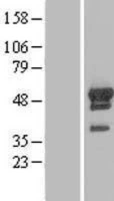 Western Blot: ARFGAP1 Overexpression Lysate (Adult Normal) [NBL1-07655] Left-Empty vector transfected control cell lysate (HEK293 cell lysate); Right -Over-expression Lysate for ARFGAP1.