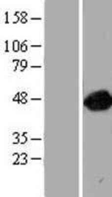 Western Blot: ARFGAP1 Overexpression Lysate (Adult Normal) [NBP2-06850] Left-Empty vector transfected control cell lysate (HEK293 cell lysate); Right -Over-expression Lysate for ARFGAP1.