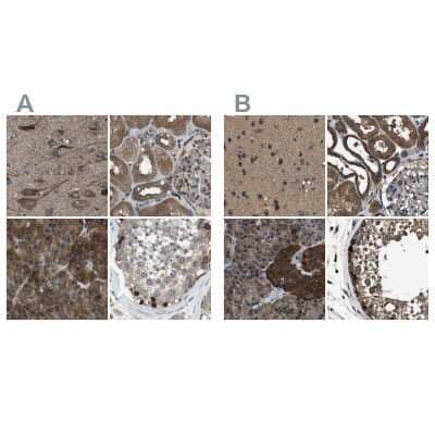 Immunohistochemistry-Paraffin ARFGAP2 Antibody