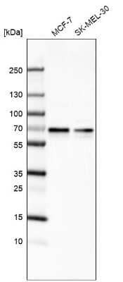 Western Blot ARFGAP2 Antibody