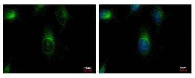 Immunocytochemistry/Immunofluorescence: ARFGAP3 Antibody [NBP1-31064] - Sample: HeLa cells were fixed in -20C 100% MeOH for 5 min. Green: ARFGAP3 protein stained by ARFGAP3 antibody, C-term diluted at 1:500. Blue: Hoechst 33343 staining.