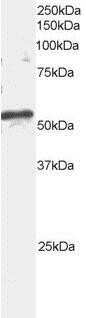 Western Blot: ARFGAP3 Antibody [NB100-843] - (2ug/ml) of mouse brain extracts (RIPA buffer, 35ug total protein per lane). Primary incubated for 1 hour. Detected by western blot using chemiluminescence.