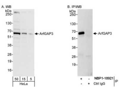 Western Blot: ARFGAP3 Antibody [NBP1-18921] - Whole cell lysate from HeLa cells.