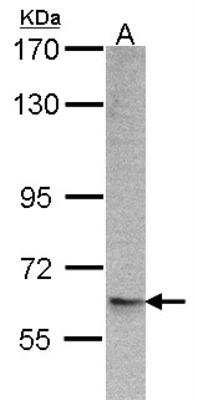 Western Blot: ARFGAP3 Antibody [NBP1-31064] - Sample(30 ug of whole cell lysate)A:293T7. 5% SDS PAGE, antibody diluted at 1:500.