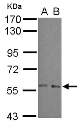 Western Blot: ARFGAP3 Antibody [NBP2-15442] - Sample (30 ug of whole cell lysate) A: A549 B: HeLa 7. 5% SDS PAGE; antibody diluted at 1:1000.