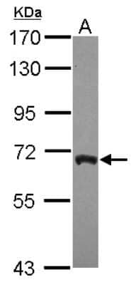 Western Blot: ARFGAP3 Antibody [NBP2-15443] - Sample (30 ug of whole cell lysate) A: IMR32 7.5% SDS PAGE; antibody diluted at 1:1000.