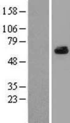 Western Blot: ARFGAP3 Overexpression Lysate (Adult Normal) [NBL1-07657] Left-Empty vector transfected control cell lysate (HEK293 cell lysate); Right -Over-expression Lysate for ARFGAP3.