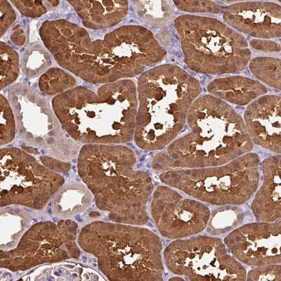 Immunohistochemistry: ARFIP1 Antibody [NBP2-38342] - Staining of human kidney shows strong cytoplasmic and nuclear positivity in cells in tubules.