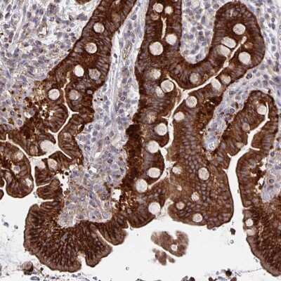 Immunohistochemistry: ARFIP1 Antibody [NBP2-39002] - Staining of human small intestine shows strong cytoplasmic positivity in glandular cells.