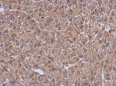 Immunohistochemistry-Paraffin: ARFIP1 Antibody [NBP2-15444] - Analysis of paraffin-embedded U87 xenograft, using antibody at 1:500 dilution.