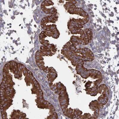 Immunohistochemistry-Paraffin ARFIP1 Antibody