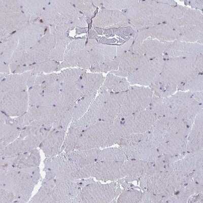 Immunohistochemistry-Paraffin: ARFIP1 Antibody [NBP2-39002] - Staining of human skeletal muscle shows low expression as expected.