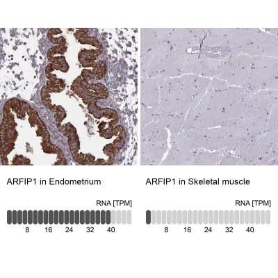 Immunohistochemistry-Paraffin ARFIP1 Antibody