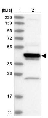 Western Blot: ARFIP1 Antibody [NBP2-38342] - Lane 1: Marker  [kDa] 230, 130, 95, 72, 56, 36, 28, 17, 11.  Lane 2: Human cell line RT-4