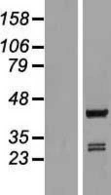 Western Blot: ARFIP1 Overexpression Lysate (Adult Normal) [NBL1-07658] Left-Empty vector transfected control cell lysate (HEK293 cell lysate); Right -Over-expression Lysate for ARFIP1.