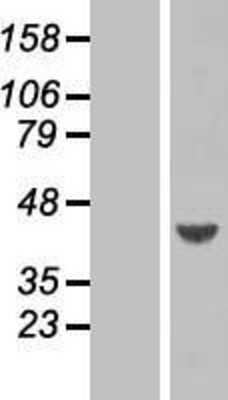 Western Blot: ARFIP1 Overexpression Lysate (Adult Normal) [NBP2-07334] Left-Empty vector transfected control cell lysate (HEK293 cell lysate); Right -Over-expression Lysate for ARFIP1.