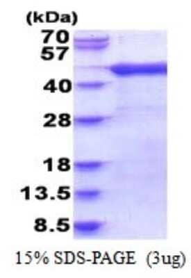 SDS-Page: ARFIP1 Recombinant Protein [NBP2-51834] - 15% SDS Page (3 ug)