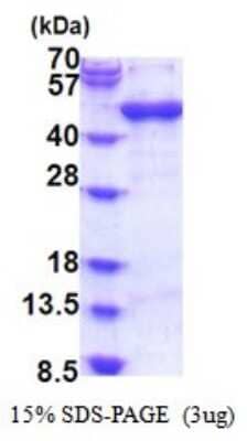 SDS-Page: ARFIP1 Recombinant Protein [NBP2-51835] - 15% SDS Page (3 ug)