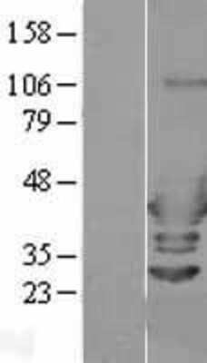 Western Blot: ARFIP2 Overexpression Lysate (Adult Normal) [NBL1-07660] Left-Empty vector transfected control cell lysate (HEK293 cell lysate); Right -Over-expression Lysate for ARFIP2.