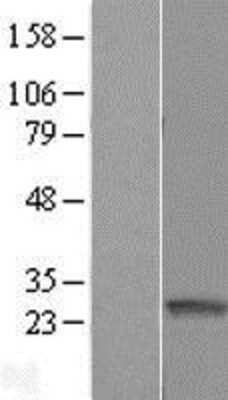 Western Blot: ARFRP1 Overexpression Lysate (Adult Normal) [NBL1-07661] Left-Empty vector transfected control cell lysate (HEK293 cell lysate); Right -Over-expression Lysate for ARFRP1.