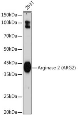 Western Blot: ARG2 Antibody (1Y5U3) [NBP3-15697] - Western blot analysis of extracts of 293T cells, using Arginase 2 (ARG2) antibody (NBP3-15697) at 1:1000 dilution. Secondary antibody: HRP Goat Anti-Rabbit IgG (H+L) at 1:10000 dilution. Lysates/proteins: 25ug per lane. Blocking buffer: 3% nonfat dry milk in TBST. Detection: ECL Basic Kit. Exposure time: 180s.