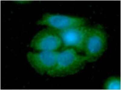 Immunocytochemistry/Immunofluorescence: ARG2 Antibody (7F8) [NBP2-59406] - Analysis of ARG2 in SW480 cells line, stained with DAPI (Blue) for nucleus staining and monoclonal anti-human ARG2 antibody (1:100) with goat anti-mouse IgG-Alexa fluor 488 conjugate (Green).