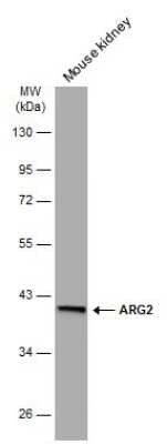 Western Blot: ARG2 Antibody (GT11111) [NBP3-13616] - Mouse tissue extract (50 ug) was separated by 10% SDS-PAGE, and the membrane was blotted with ARG2 antibody [GT11111] (NBP3-13616) diluted at 1:1000. The HRP-conjugated anti-mouset IgG antibody (NBP2-19382) was used to detect the primary antibody.