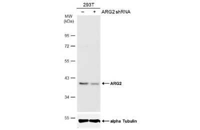 Western Blot: ARG2 Antibody (GT11111) [NBP3-13616] - Non-transfected (-) and transfected (+) 293T whole cell extracts (50 ug) were separated by 12% SDS-PAGE, and the membrane was blotted with ARG2 antibody [GT11111] (NBP3-13616) diluted at 1:1000. The HRP-conjugated anti-mouse IgG antibody (NBP2-19382) was used to detect the primary antibody.