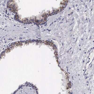 <b>Orthogonal Strategies Validation. </b>Immunohistochemistry-Paraffin: ARG2 Antibody [NBP1-86189] - Staining of human prostate shows high expression.